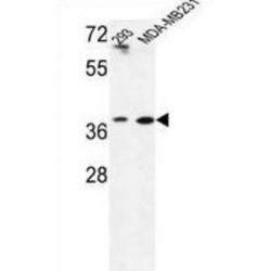 Methionine Adenosyltransferase II Beta (MAT2B) Antibody