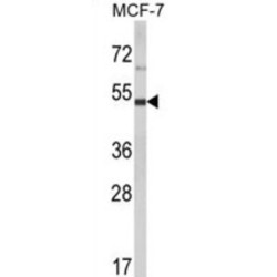 LUC7 Like 2, Pre-mRNA Splicing Factor (LUC7L2) Antibody