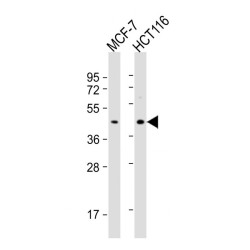 Pregnancy Specific Beta-1-Glycoprotein 3 (PSG3) Antibody