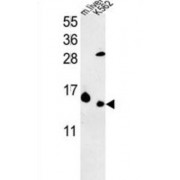 Ribosomal Protein L37 (RPL37) Antibody