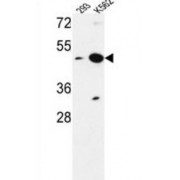 Nucleoporin NUP42 / NUPL2 (NUP42) Antibody
