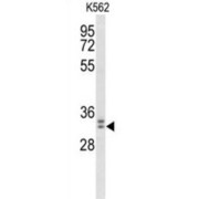 Mitogen-Activated Protein Kinase Organizer 1 (MORG1) Antibody