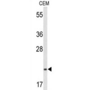 TRAF-Interacting Protein With FHA Domain-Containing Protein A (TIFA) Antibody