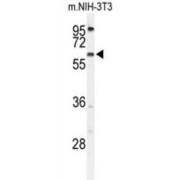 Transmembrane Protein 108 (TMEM108) Antibody