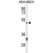 Chromobox Protein Homolog 2 (CBX2) Antibody