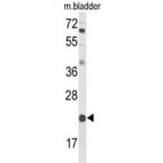 DiGeorge Syndrome Critical Region 6 (DGCR6) Antibody