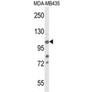 Jumonji Domain-Containing Protein 2B (JMJD2B) Antibody