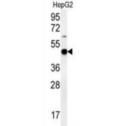 Pyruvate Dehydrogenase E1 Component Subunit Alpha, Somatic Form, Mitochondrial (PDHA1) Antibody