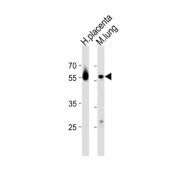 Cyclic AMP-Responsive Element Binding Protein 3 Like Protein 2 (CREB3L2) Antibody