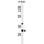 Enoyl CoA Hydratase Domain Containing 1 (ECHDC1) Antibody