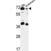 Eukaryotic Peptide Chain Release Factor GTP-Binding Subunit ERF3B (ERF3B) Antibody