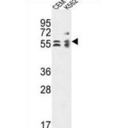 Tubulin-Specific Chaperone E (TBCE) Antibody