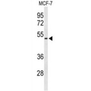 Feline Leukemia Virus Subgroup C Receptor-Related Protein 2 (FLVC2) Antibody