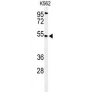 Calcium-Binding Atopy-Related Autoantigen 1 (CBAA1) Antibody