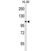 ALL1-Fused Gene From Chromosome 5q31 Protein (AF5q31) Antibody