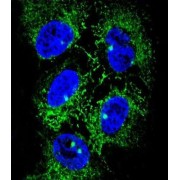 Alcohol Dehydrogenase Class 4 Mu/Sigma Chain (ADH7) Antibody