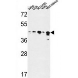 Alcohol Dehydrogenase Class 4 Mu/Sigma Chain (ADH7) Antibody