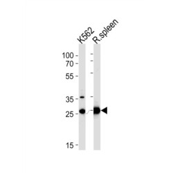 Solute Carrier Family 25 Member 37 (SLC25A37) Antibody