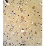 Leucine Rich Repeat Transmembrane Neuronal 1 (LRRTM1) Antibody