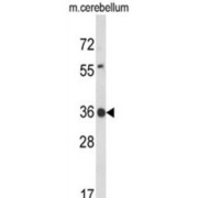 Claudin Domain Containing 1 (CLDND1) Antibody