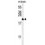 Nucleosome Assembly Protein 1-Like 5 (NP1L5) Antibody