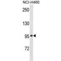 Zinc Finger Protein 473 (ZN473) Antibody