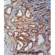 MOCO Sulphurase C-Terminal Domain Containing Protein 1 (MOSC1) Antibody