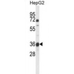 MOCO Sulphurase C-Terminal Domain Containing Protein 1 (MOSC1) Antibody