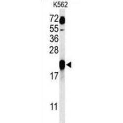 G Antigen 7 (GAGE7) Antibody