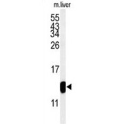 Transmembrane Inner Ear Expressed Protein (TMIE) Antibody