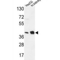 NADH Ubiquinone Oxidoreductase Subunit A10 (NDUFA10) Antibody