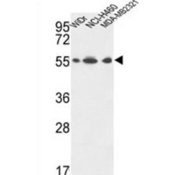 ATP Synthase Subunit Alpha, Mitochondrial (ATP5F1A) Antibody