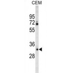 Carbonic Anhydrase 6 (CA6) Antibody