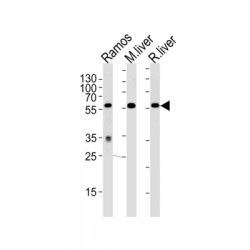 Glucose 6 Phosphate Isomerase (GPI) Antibody