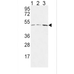 Hyaluronan And Proteoglycan Link Protein 1 (HAPLN1) Antibody