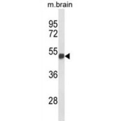 Forkhead Box Protein G1 (FOXG1) Antibody