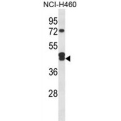 Isocitrate Dehydrogenase [NAD] Subunit Gamma, Mitochondrial (IDH3G) Antibody