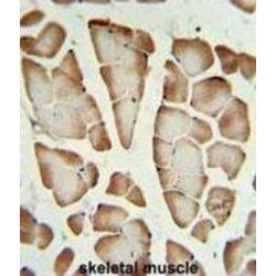 Syntaxin-1A (STX1A) Antibody