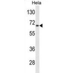 Alanine Glyoxylate Aminotransferase 2 (AGXT2) Antibody