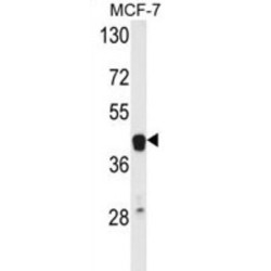 V-Ets Erythroblastosis Virus E26 Oncogene Homolog 2 (Avian) (ETS2) Antibody