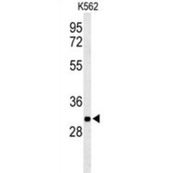 Glycerol-3-Phosphate Phosphatase (PGP) Antibody