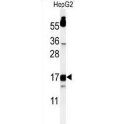 TYRO Protein Tyrosine Kinase Binding Protein (TYROBP) Antibody