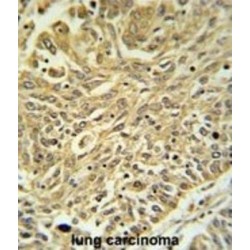 Glutathione S Transferase Kappa 1 (GSTK1) Antibody