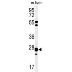 Glutathione S Transferase Kappa 1 (GSTK1) Antibody