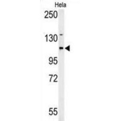 Adenylate Cyclase 4 (ADCY4) Antibody