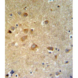 G2 And S Phase-Expressed Protein 1 (GTSE1) Antibody