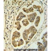 Holocytochrome C Synthase (HCCS) Antibody