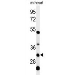 Holocytochrome C Synthase (HCCS) Antibody