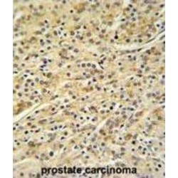 Homeobox Protein Hox-A3 (HOXA3) Antibody