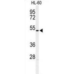 Homeobox Protein Hox-A3 (HOXA3) Antibody